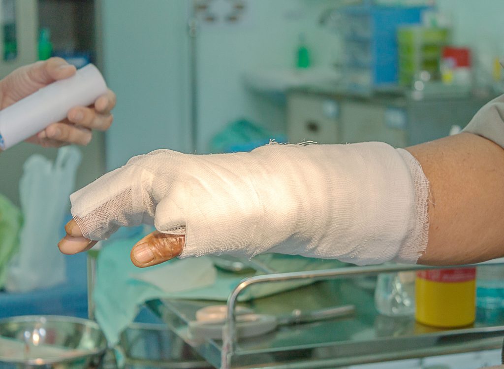 Pahrump Burn Injury Attorney